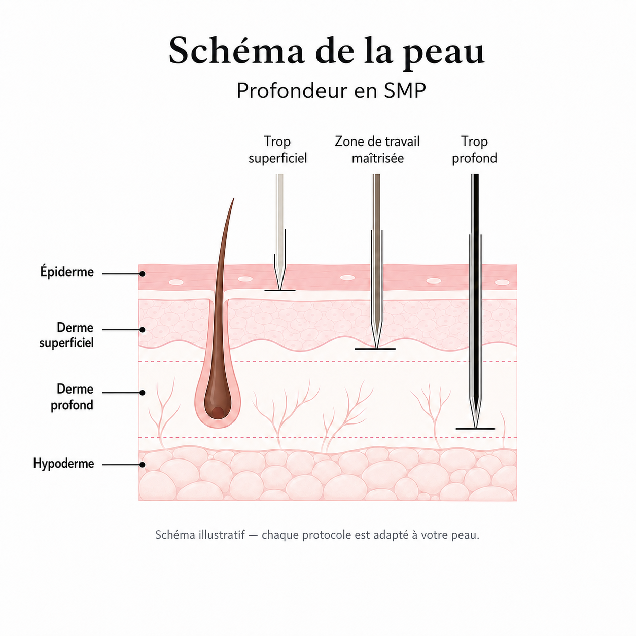 Schéma de la peau montrant la profondeur d’une micropigmentation capillaire